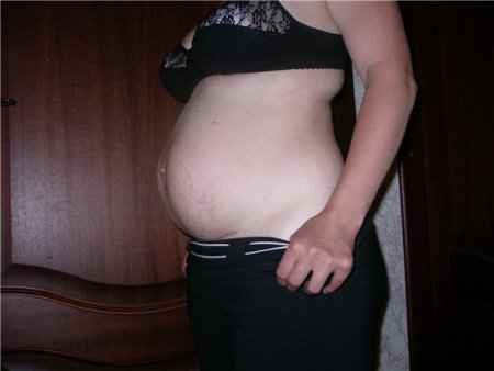 живот после родов Диастаз, обвисший живот, некрасивый живот, убрать живот, беременный живот после родов