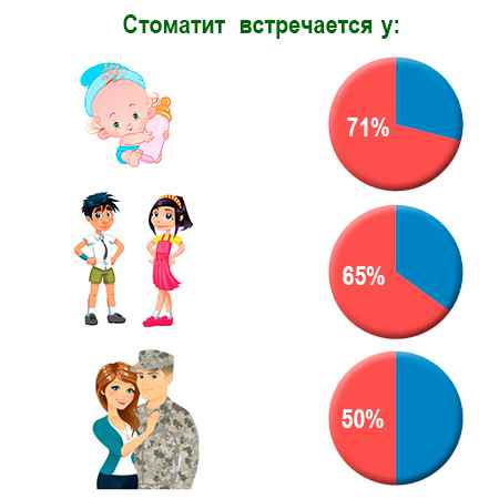 Стоматит у детей