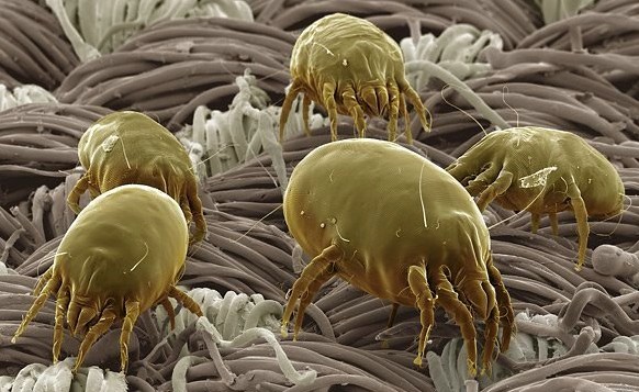 Аллергия «на пыль»: чем опасны пылевые клещи и как с ними бороться