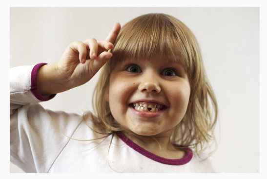 Молочные зубы